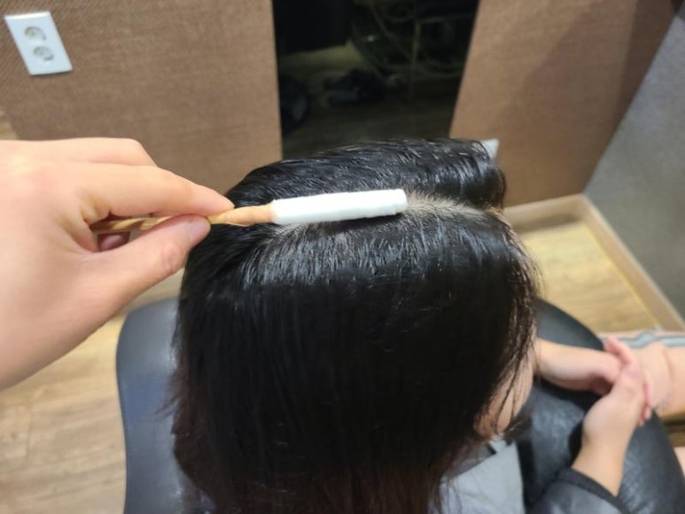 온스칼프 이미지