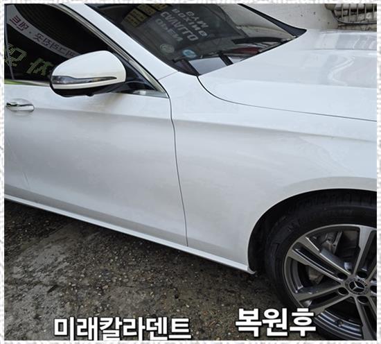 미래덴트칼라 이미지