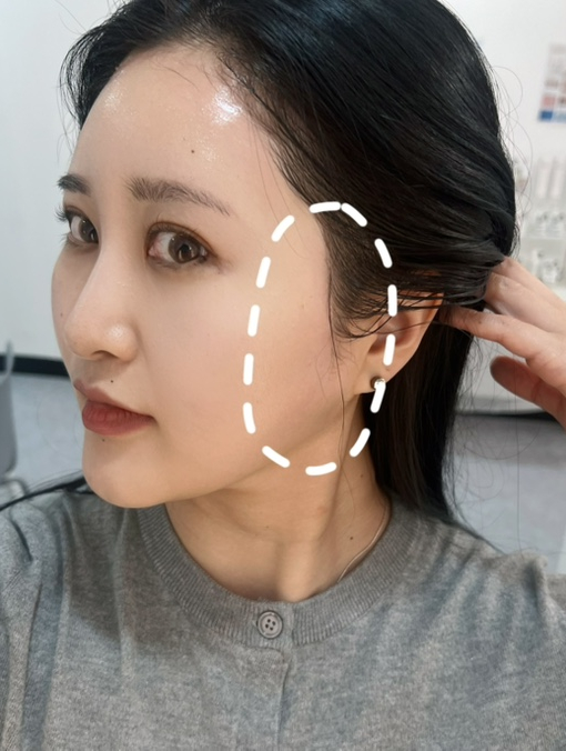 가온스킨 이미지