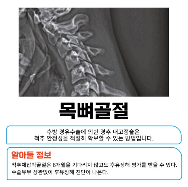 후유 이미지