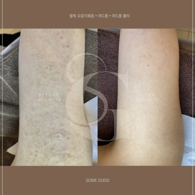 굿피부샵 이미지
