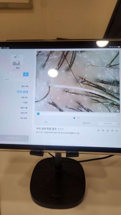 탈모케어존부산 이미지