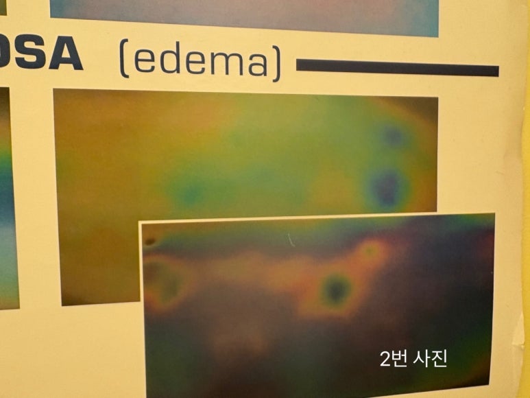 모델라지 이미지