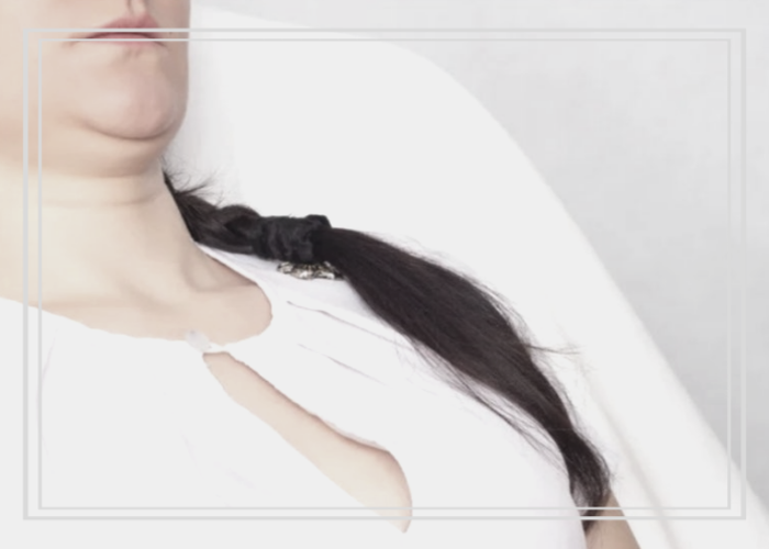 스카이쁘아뜨의원 이미지