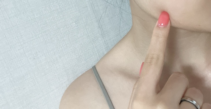 코멜리네일 이미지