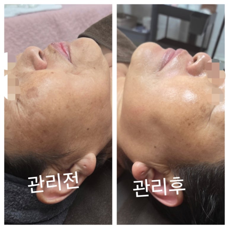 오늘은밝은피부 이미지