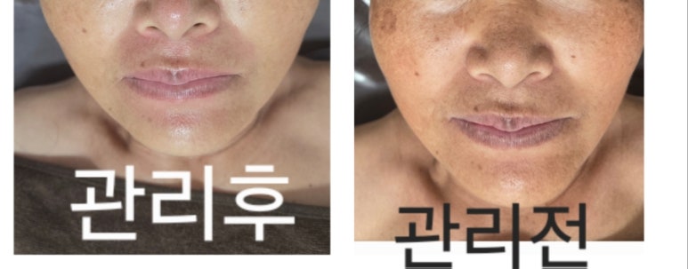 오늘은밝은피부 이미지