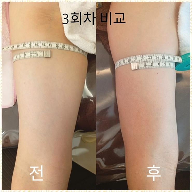 달눈뷰티 이미지
