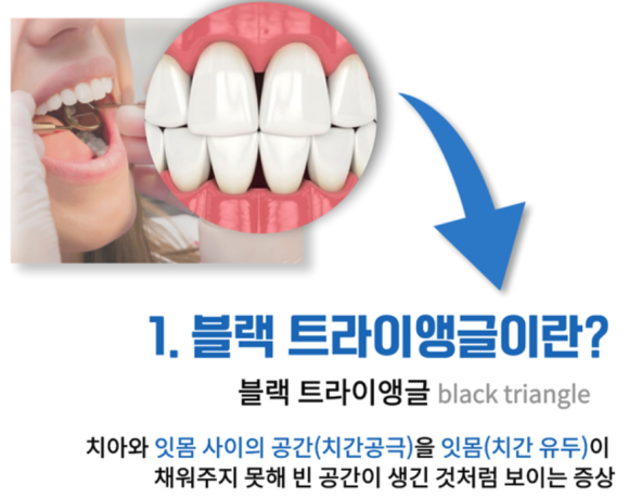 미소 그리다 이미지