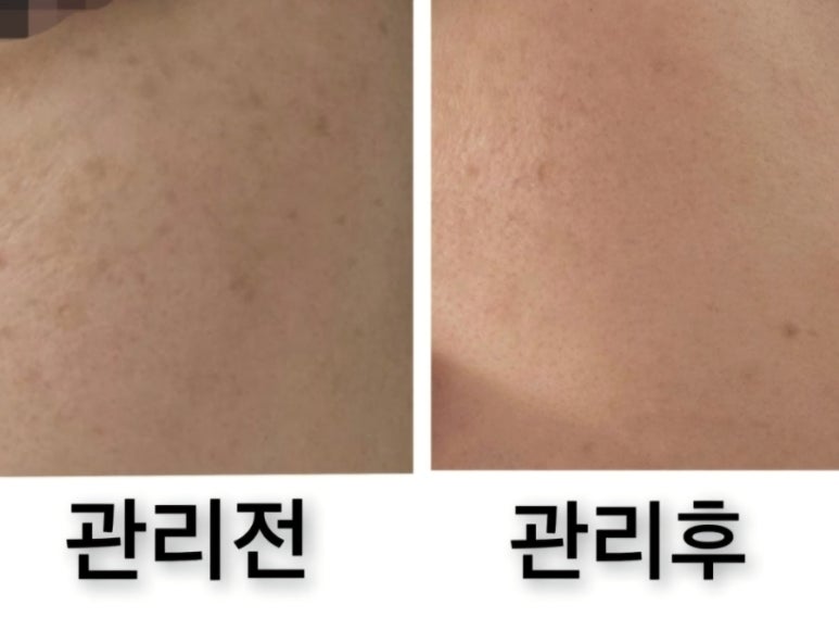 오늘은밝은피부 이미지