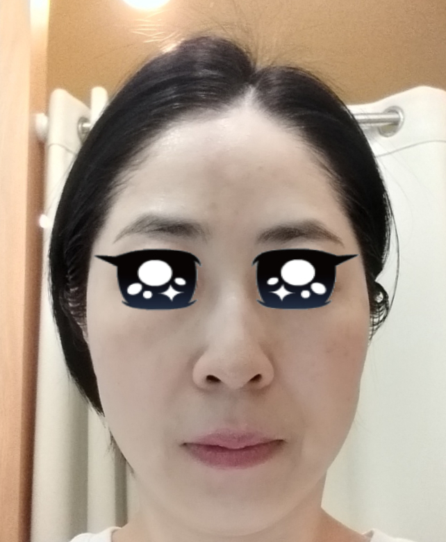 봄날에스테틱 이미지