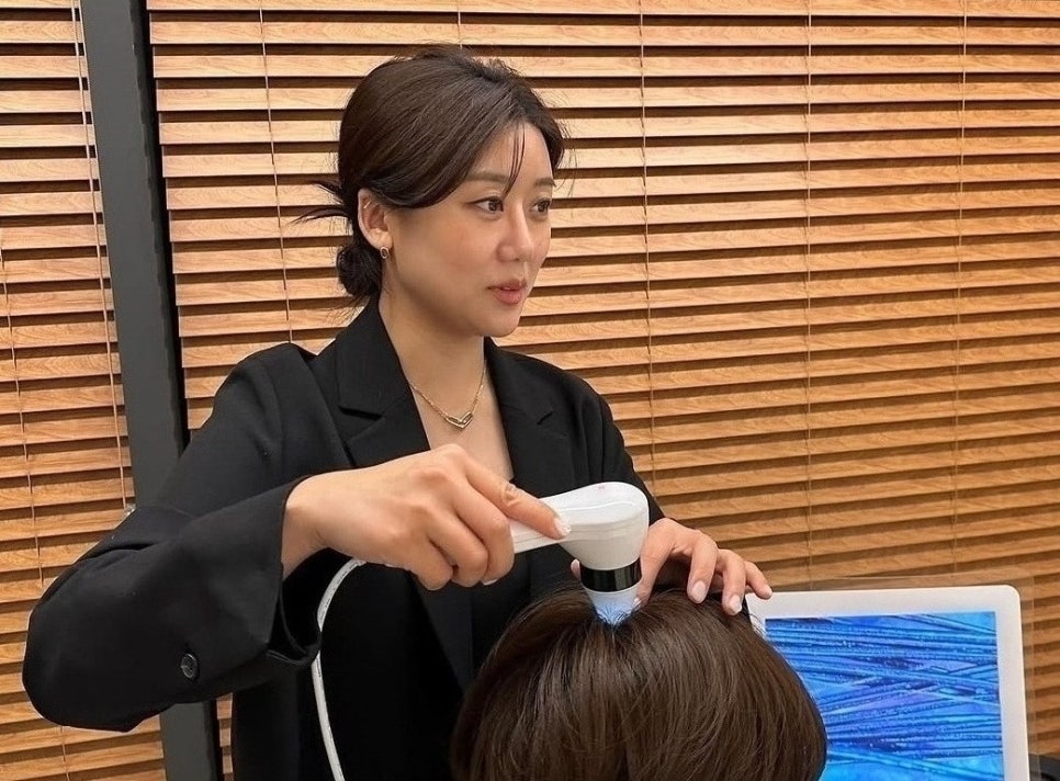 선헤어라인 이미지