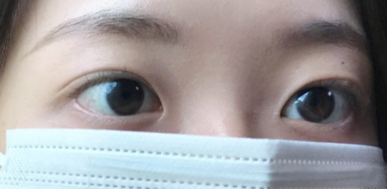 린지뷰티 이미지