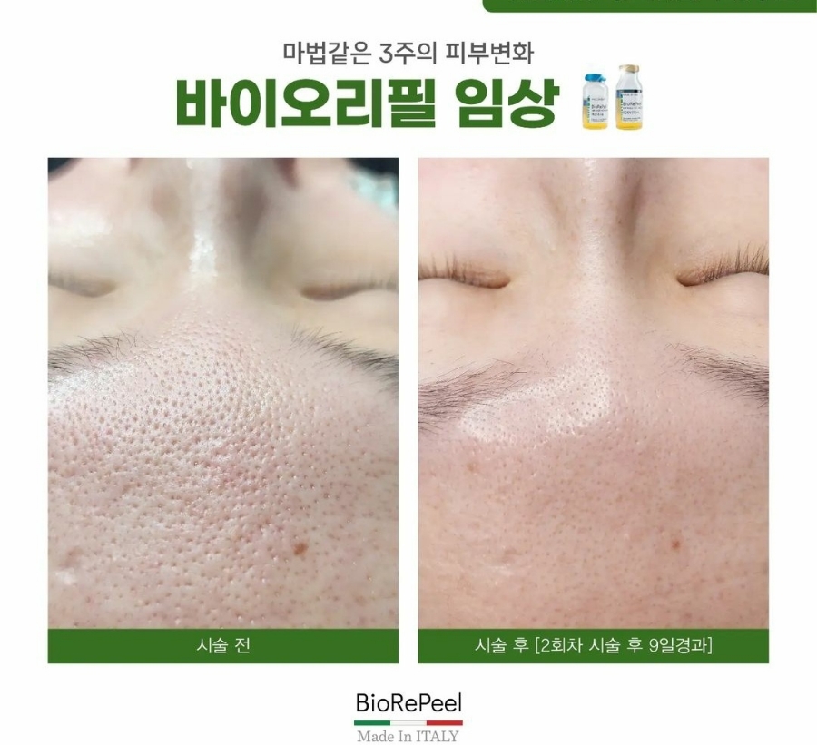 모란헤어피부샵 이미지