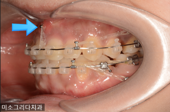 미소 그리다 이미지