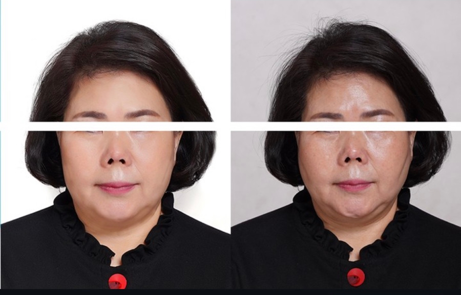 들과숲속에 이미지
