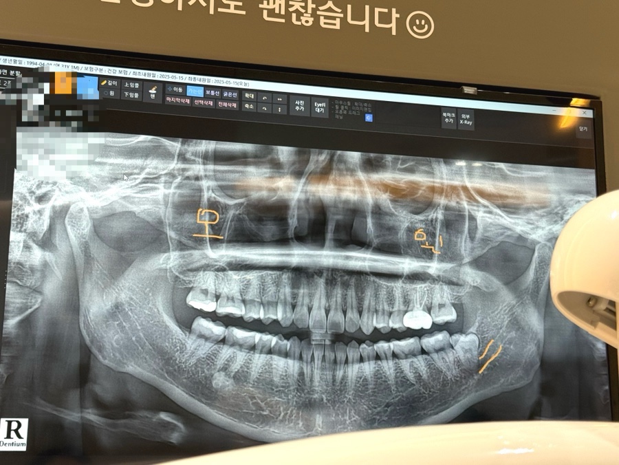 잘가요사랑니치과의원 이미지
