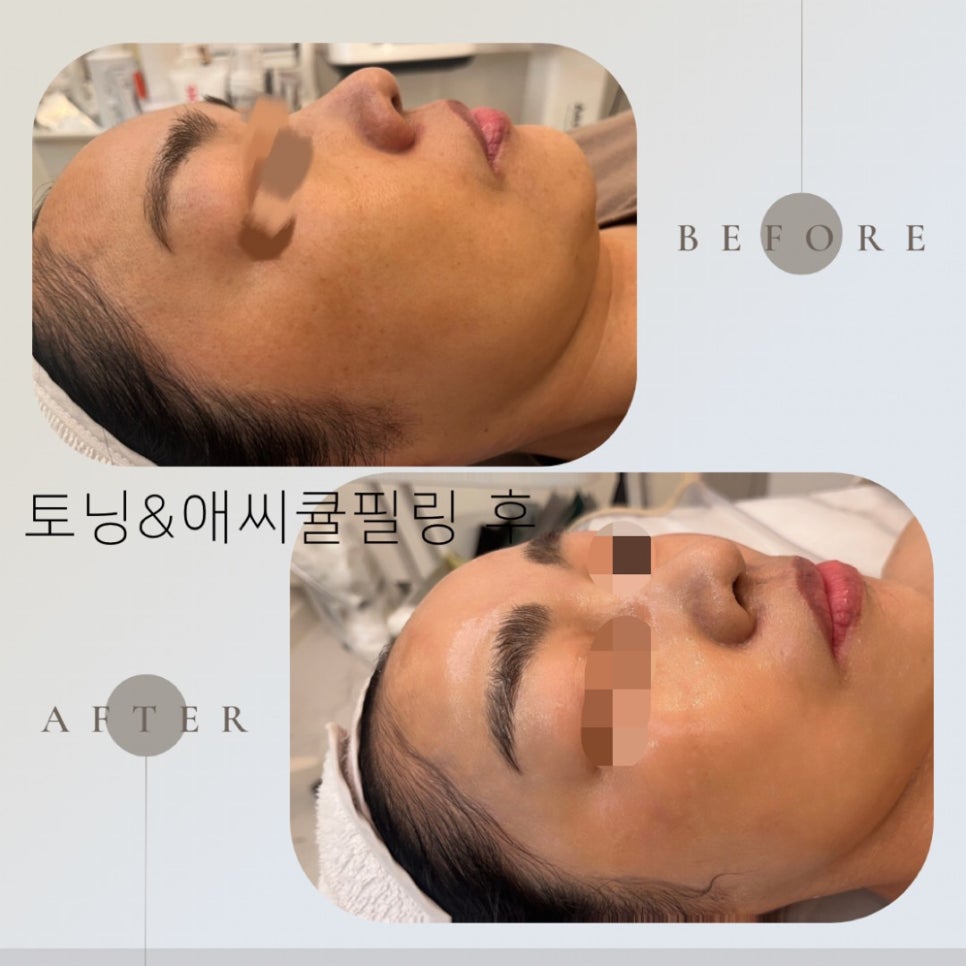 리유에스테틱 이미지