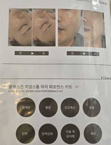 (주)클링 이미지