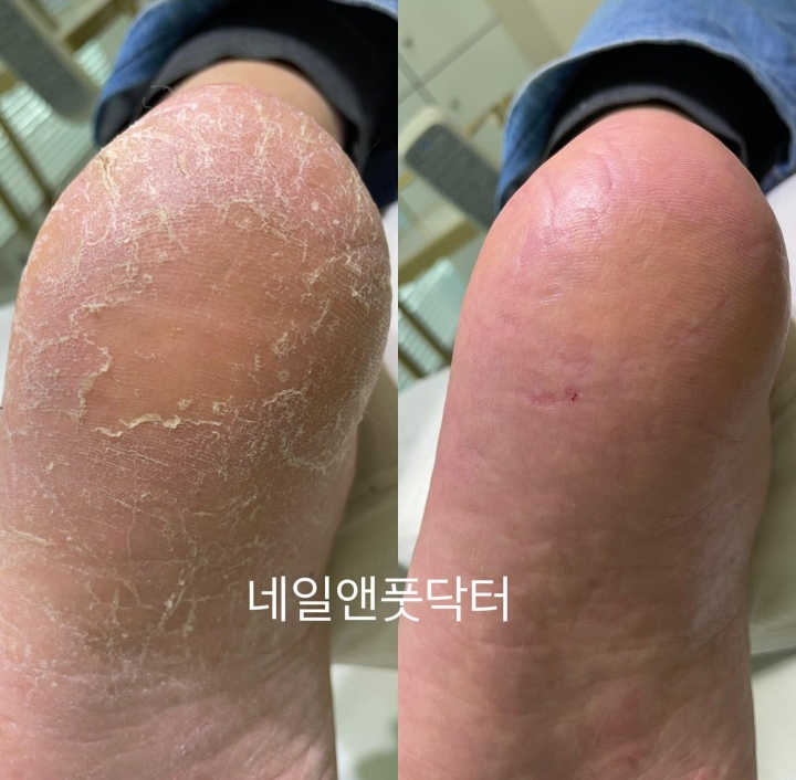 네일앤풋닥터 이미지