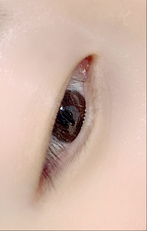 르네41 이미지