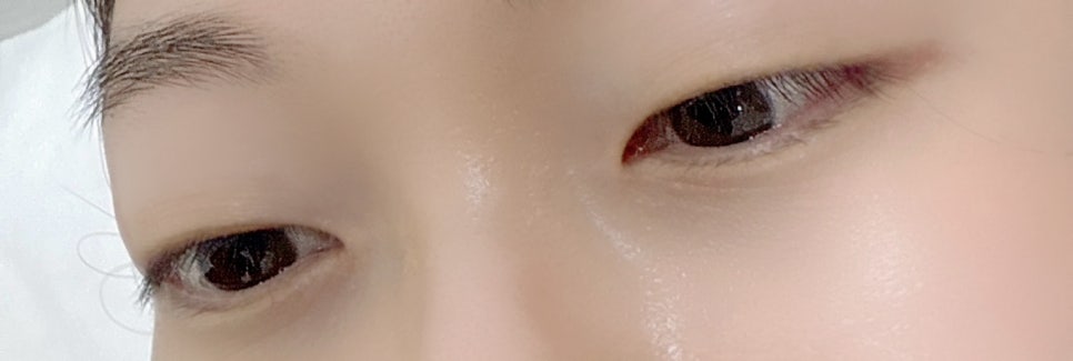 르네41 이미지