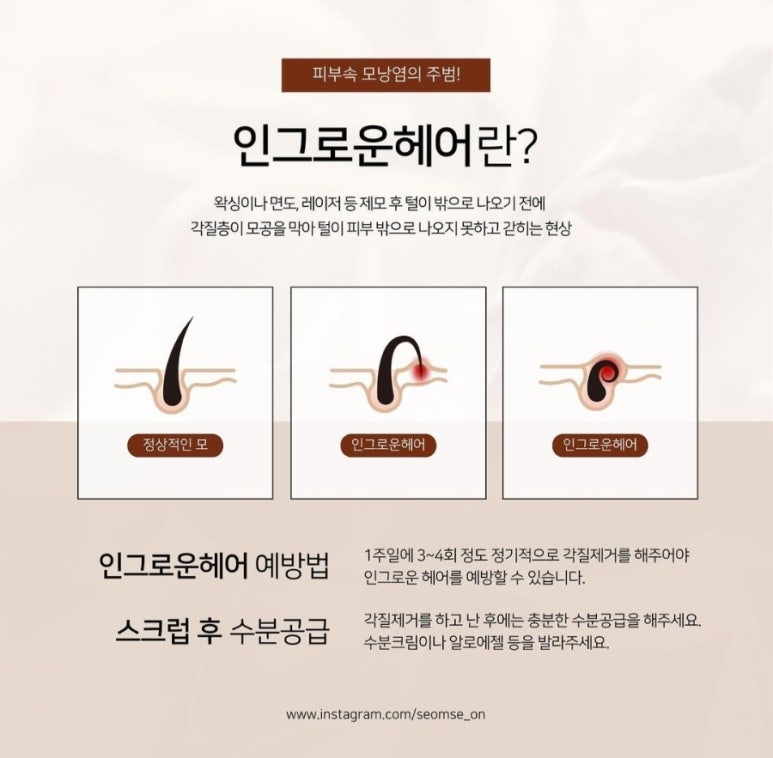 온 왁싱 이미지