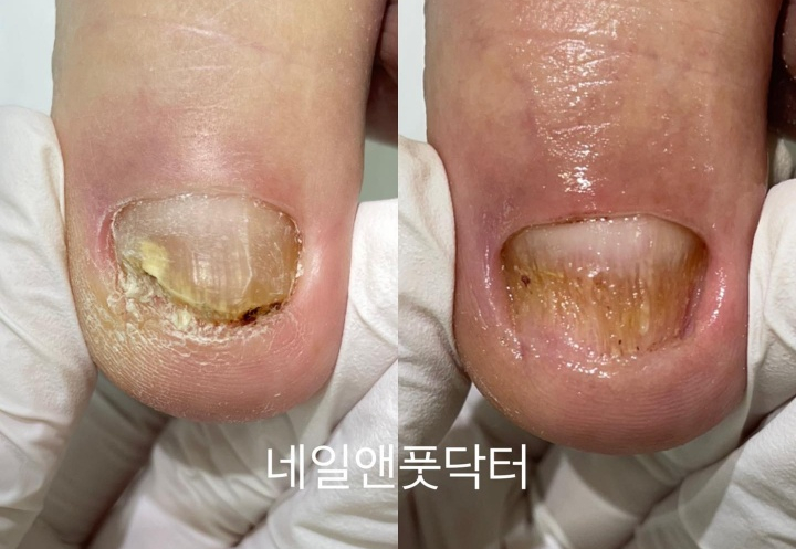 네일앤풋닥터 이미지