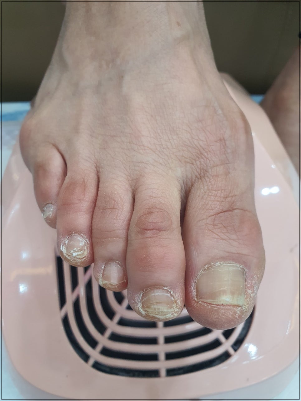루시아뷰티플러스 이미지