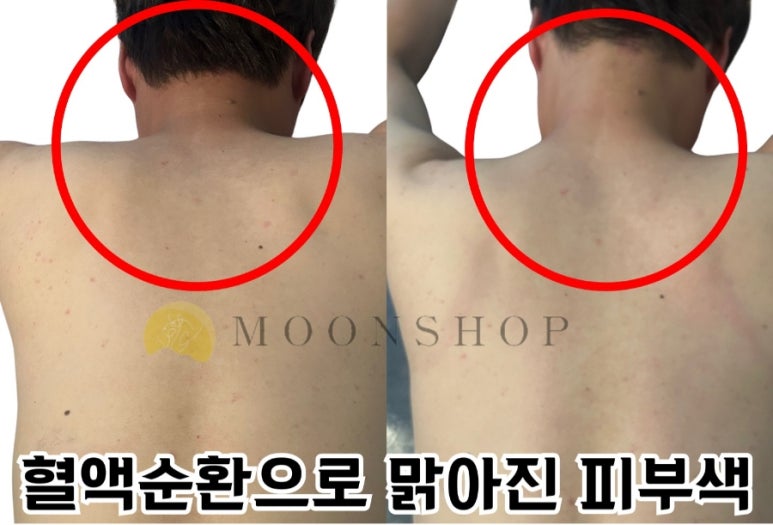 문샵 이미지