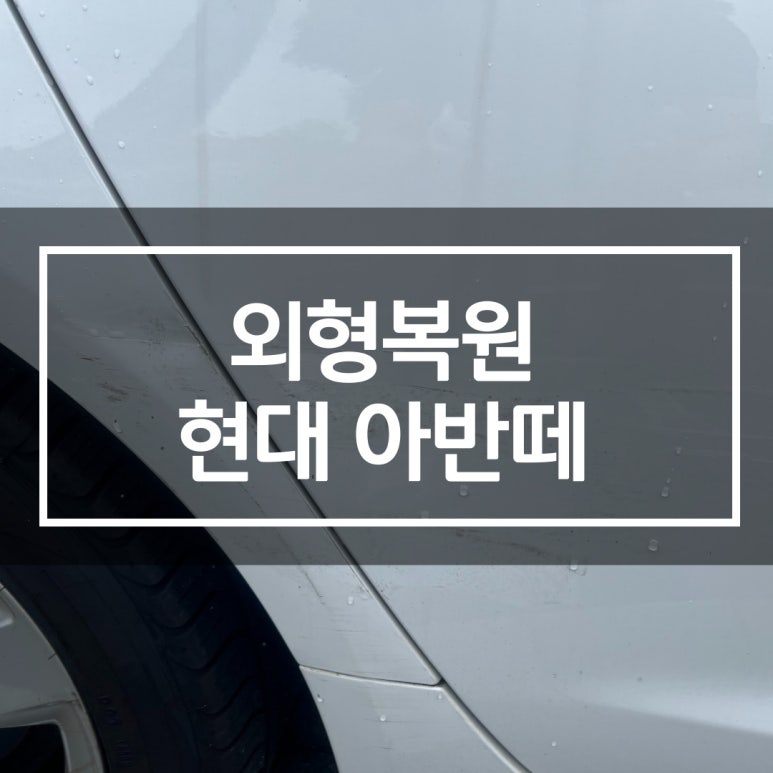 허덴트 이미지