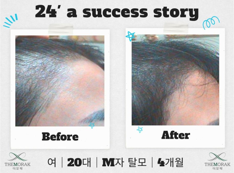 닥터모락 강남점 이미지