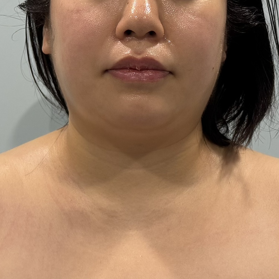 더바른테라피 이미지