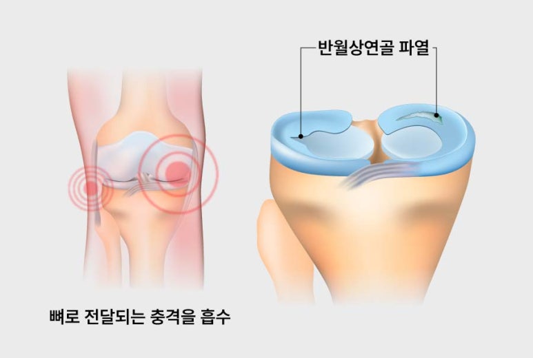 세종스포츠정형외과의원 이미지