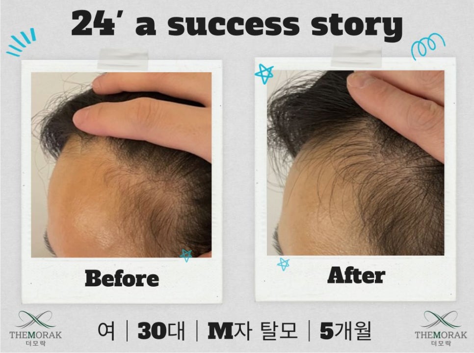 닥터지니 이미지