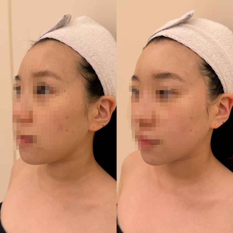 온플릭디자인 이미지