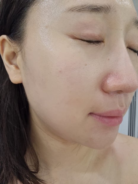 유니피부샵 이미지