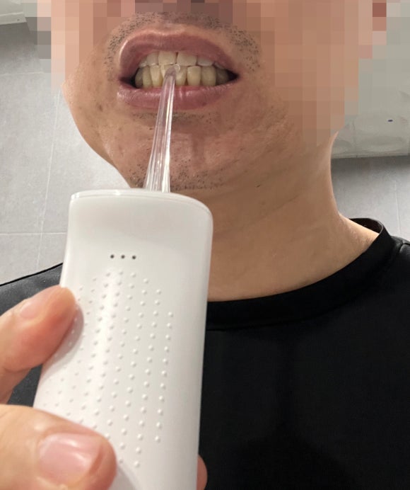 덴탈리어 이미지