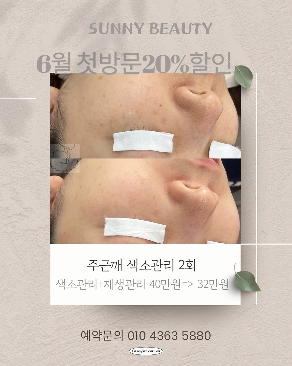 써니뷰티 이미지