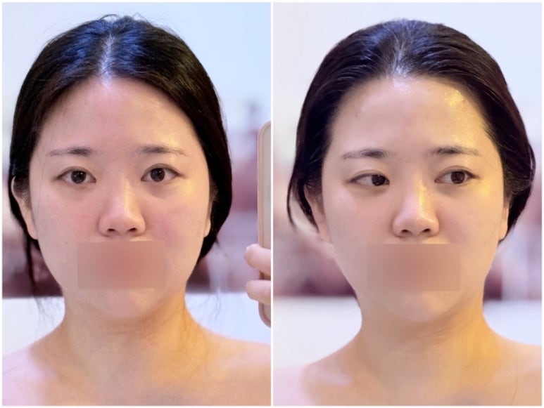 두리스킨케어 이미지