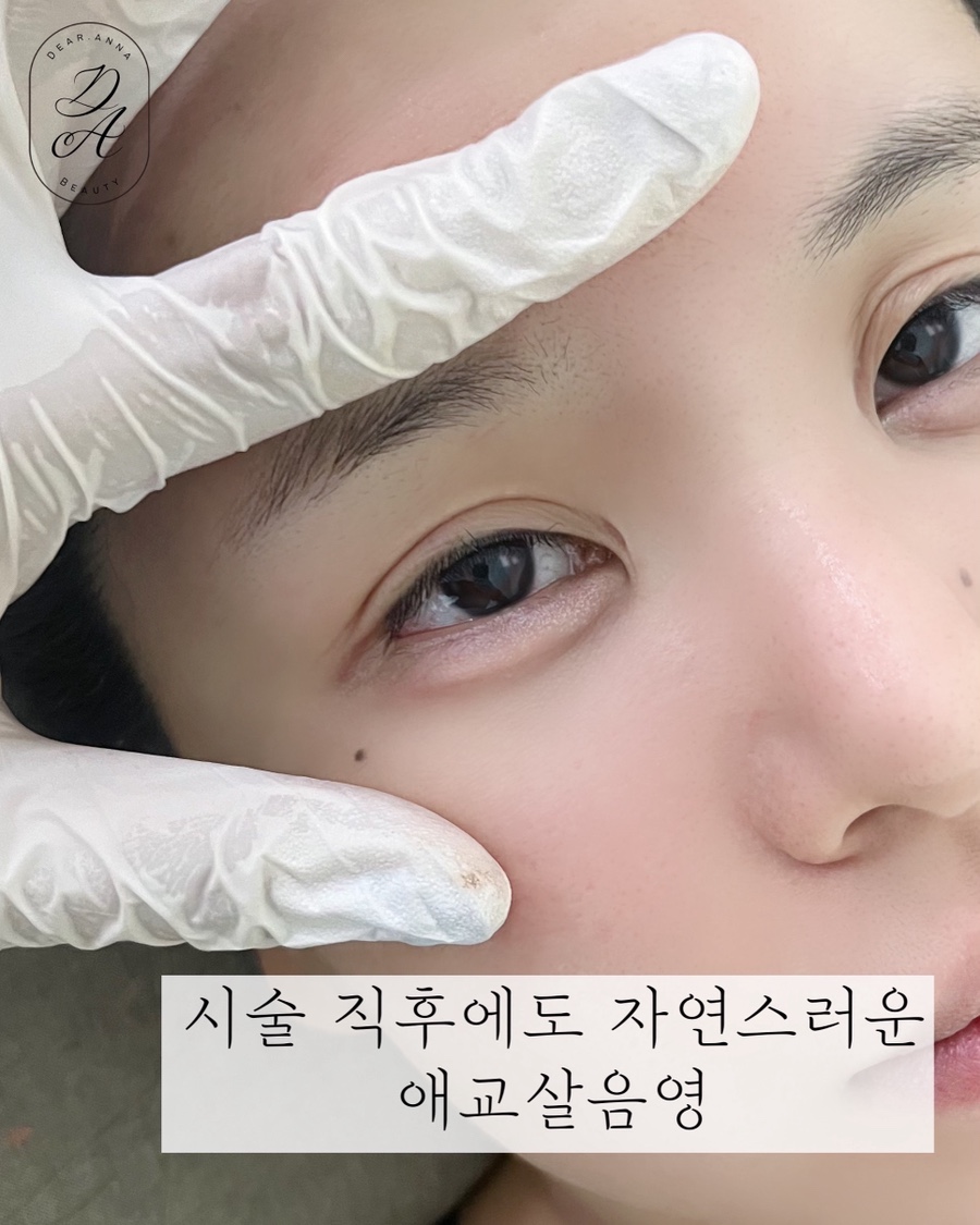 디어니즈 이미지