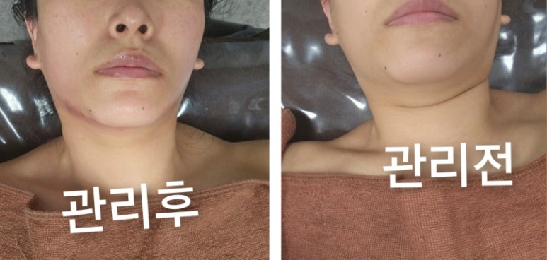 오늘은밝은피부 이미지