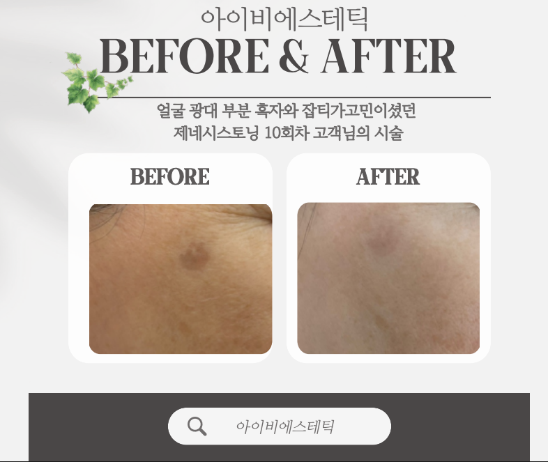 아이비에스테틱 이미지
