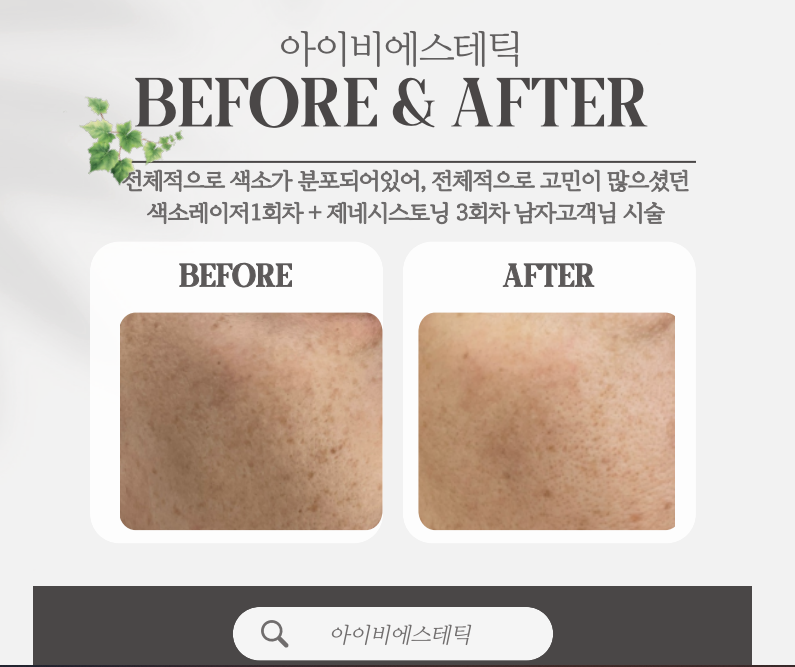아이비에스테틱 이미지