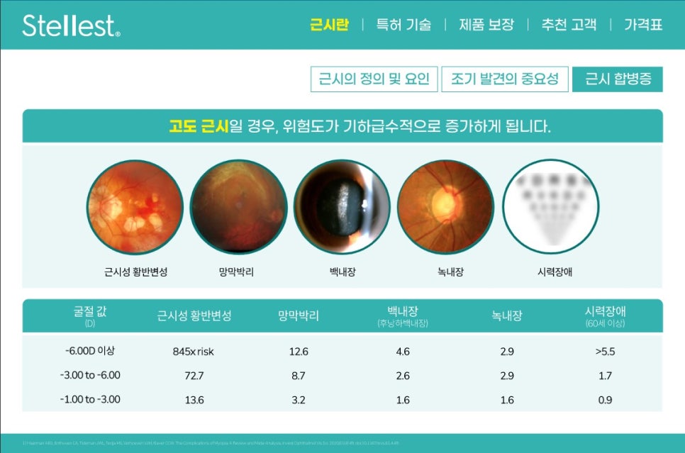 스텔 이미지