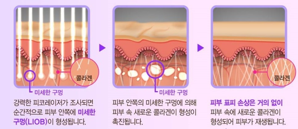 피코 이미지