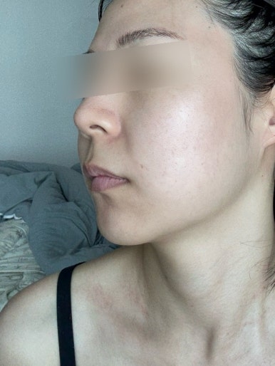 능곡예인의원 이미지