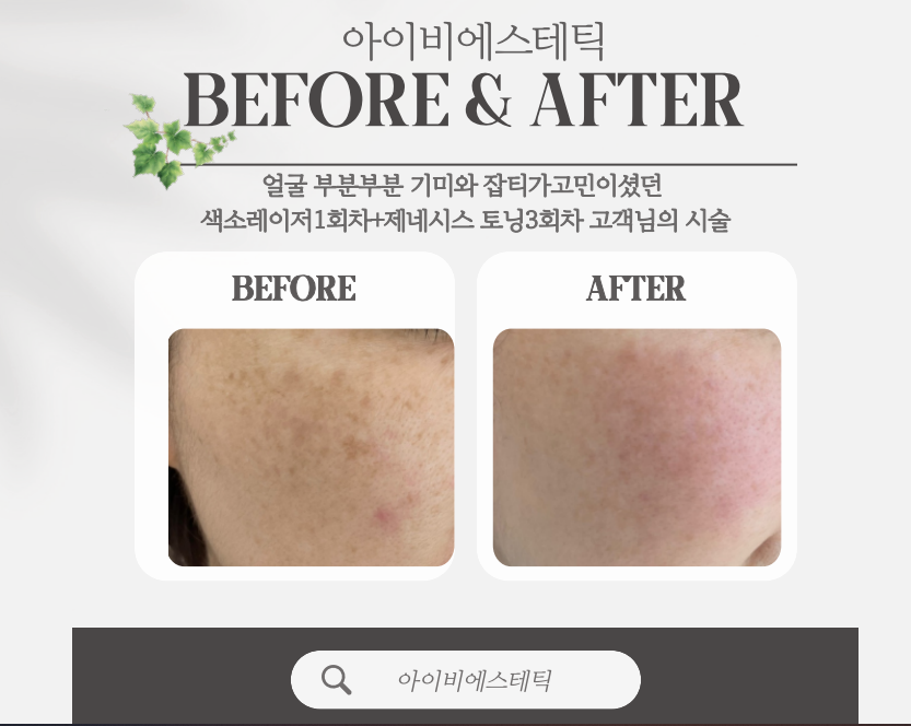 아이비에스테틱 이미지