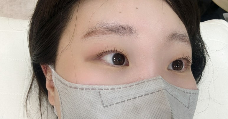 올단 이미지