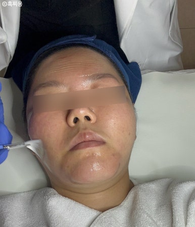 달리핀 에스테틱 이미지